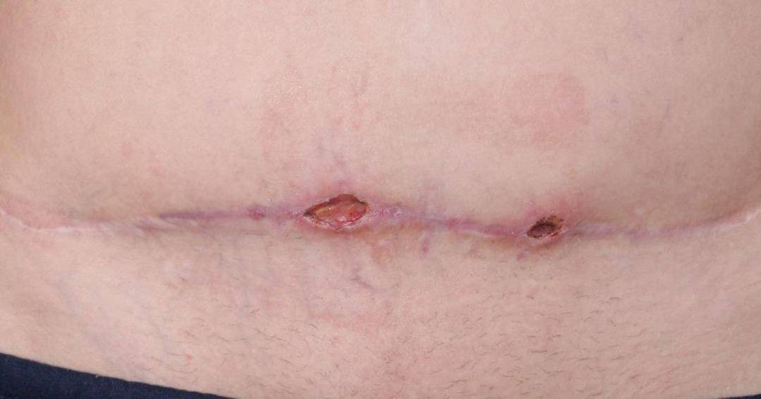 Medicalnewstoday.com